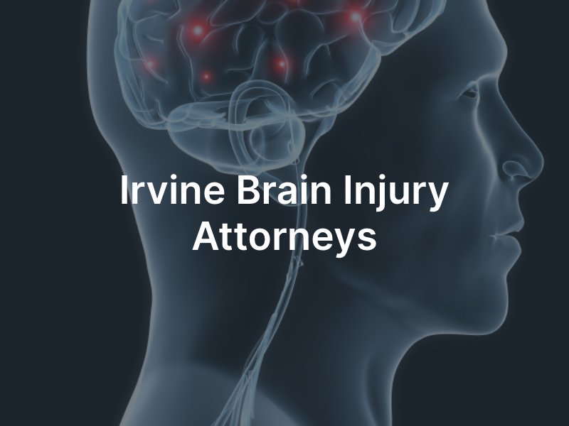 Irvine Brain Injury Lawyers 