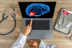 A doctor displaying a brain X-ray on a laptop, indicating pain. Concept of migraine headache diagnosis.