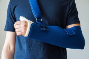 Man with a plaster cast on his thumb, wrist, and hand after a car accident injury.