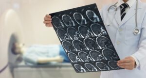 A doctor examines a patient's brain MRI scan, reviewing the X-ray film for diagnosis and treatment.