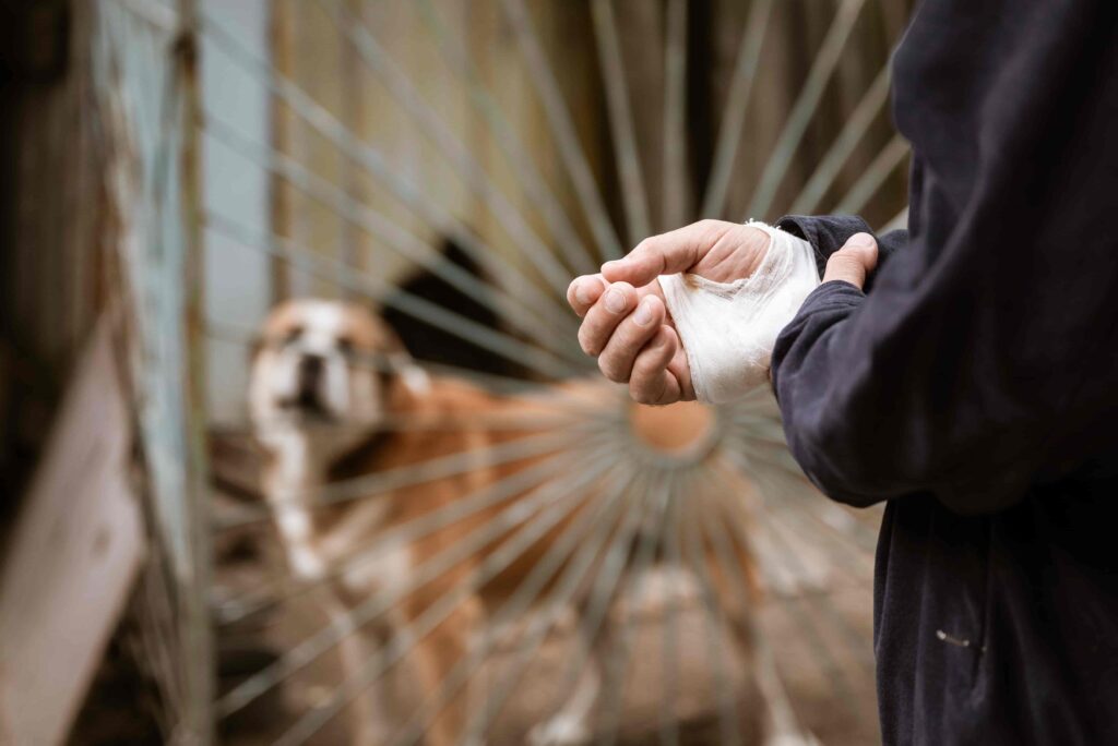 Person with a bandaged hand after a dog bite injury, aggressive dog behind fence.