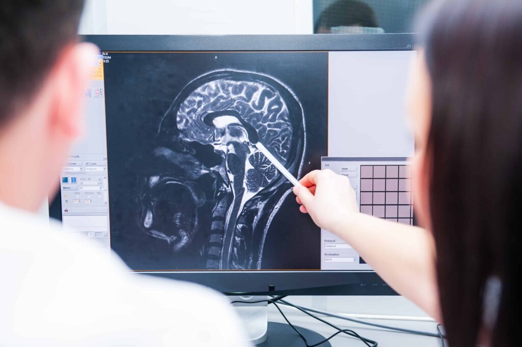 Doctor reviewing brain MRI scan on computer monitor with patient, pointing at injury area.